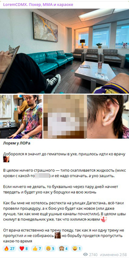Гематома